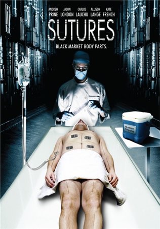 Швы / Sutures